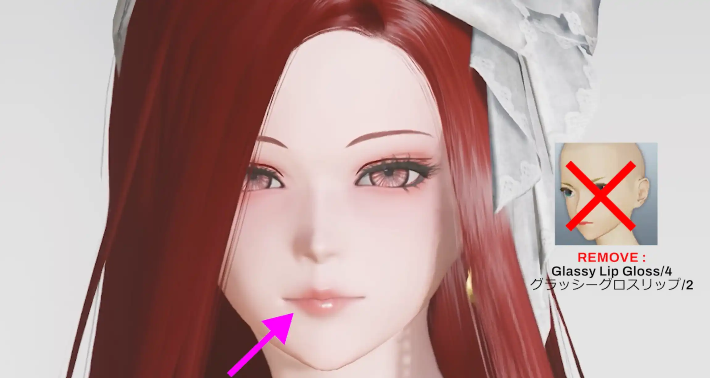 After Remove